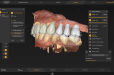 Digital Denture Workflows (CP2)