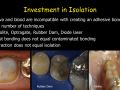 Adhesive Cementation - Part 4 Tooth Surface Preparation