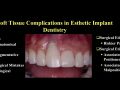 Managing soft tissue complications in esthetic implant dentistry – Part 2