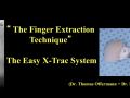 Minimally Traumatic Extractions in Implant Dentistry – Part 2