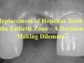 Replacement of hopeless teeth in the esthetic zone – Part 1