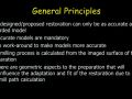 CEREC Preparations - Onlays - General Preparation Principles