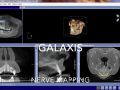 Galaxis Software - Nerve Mapping