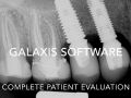 Galaxis Software - Case - Failing Endodontics