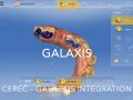 Galaxis Software - Single Implant Planning