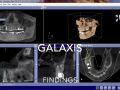 Galaxis Software - Findings