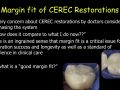 CEREC Preparations - Margin Fit - Clinically Acceptable