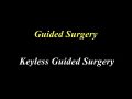 Guided Surgery Tips and Tricks – Part 1