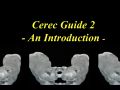 Online Continuum (Curriculum Series) - CEREC Guide 2 - Part 1