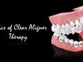 1 - Introduction To Clear Aligners