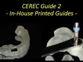 Continuum (Curriculum Series) - Surgical Video Presentation – Replacement of a Mandibular Second Molar with a Printed CEREC Guide 2
