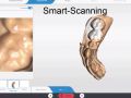 CEREC Primescan Smart Scanning