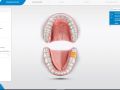 2. Administration - Designate Single Tooth Restoration