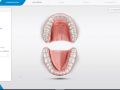 5.0.x Administration - Designate Single Tooth Restoration