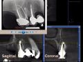 The 5 Panels Of The CBCT - Part 3
