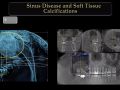 Applications for CBCT - Sinus Disease