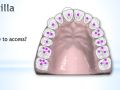 Fundamentals of Access of Anterior Teeth
