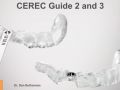 CEREC® Guide 2 and 3 Workflow