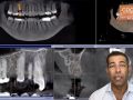 Introduction to Implant Education