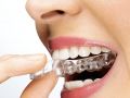 Orthodontic and SureSmile Value Proposition