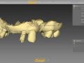 8. inLab 20 Model Software - Creating Implant Models
