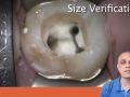 Tip of the Day - Endo Canal Size Verifier