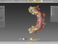 9. inLab 20 Abutments - Why To Create and Implant Model