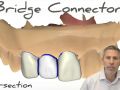 Tip of the Day - Bridge Connector