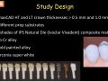 Translucency - Research Evidence - Color CAD/CAM Lithium-Disilicate Crowns - Part 2 - Results