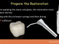 Glazing of Chairside Ceramics - Part 4 - Preparation of Restoration