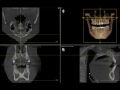 How to Review CBCT Volume