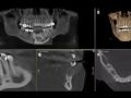 I See Something In My CBCT ... Now What?