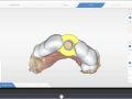 Virtual Extraction With Cut For CEREC Guide Design