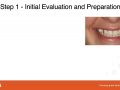 Placing Implants through Cuspids - Part 1 - Preparation