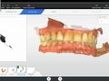Morning Occlusal Guide Workflow Using Primeprint - Starting Process