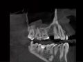 CBCT Helps with Existing Patients