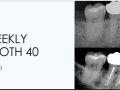 Week 1 - Weekly Tooth 40