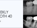 Week 3 - Weekly Tooth 40