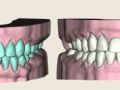 Worn Teeth pt. 1