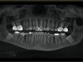 NP Exam...What Does CBCT Reveal 2