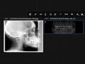 8 - 2023 DS Core Patient Radiographs