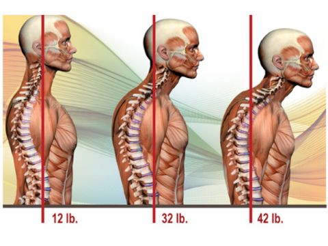 8 Exercises to Ease That Dental-Related Neck and Back Pain