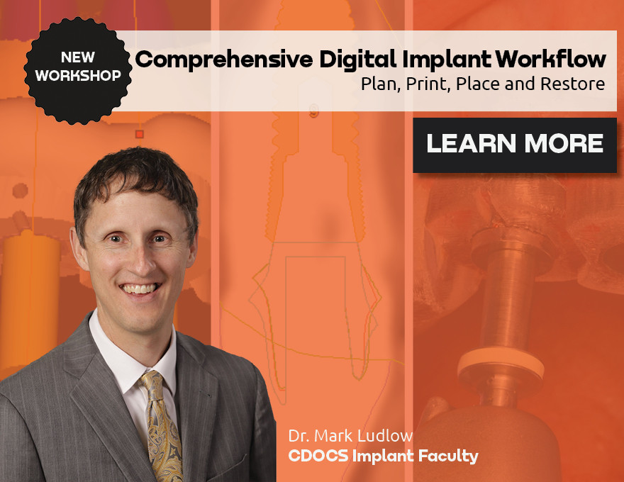 NEW WORKSHOP - Comprehensive Digital Implant Workflow