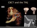Applications for CBCT - Temporomandibular Joints