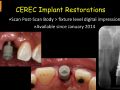 Clinical Evaluation of Chairside CAD/CAM Implant Restorations - Study Design