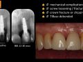 Clinical Evaluation of Chairside CAD/CAM Implant Restorations - Conclusions