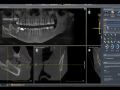 CBCT Software Layout Tabs and Ceph Tracing