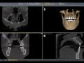 CBCT Benefits and What to Do When You See Something