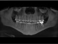 NP CBCT- Hard and Soft tissue findings