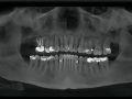 Comparing CBCT Volumes and the Changes That Can Occur